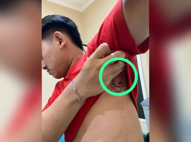 
					Brutal! Senggolan Motor Berujung Penikaman, Gengster Pasuruan Kota Diburu Polisi